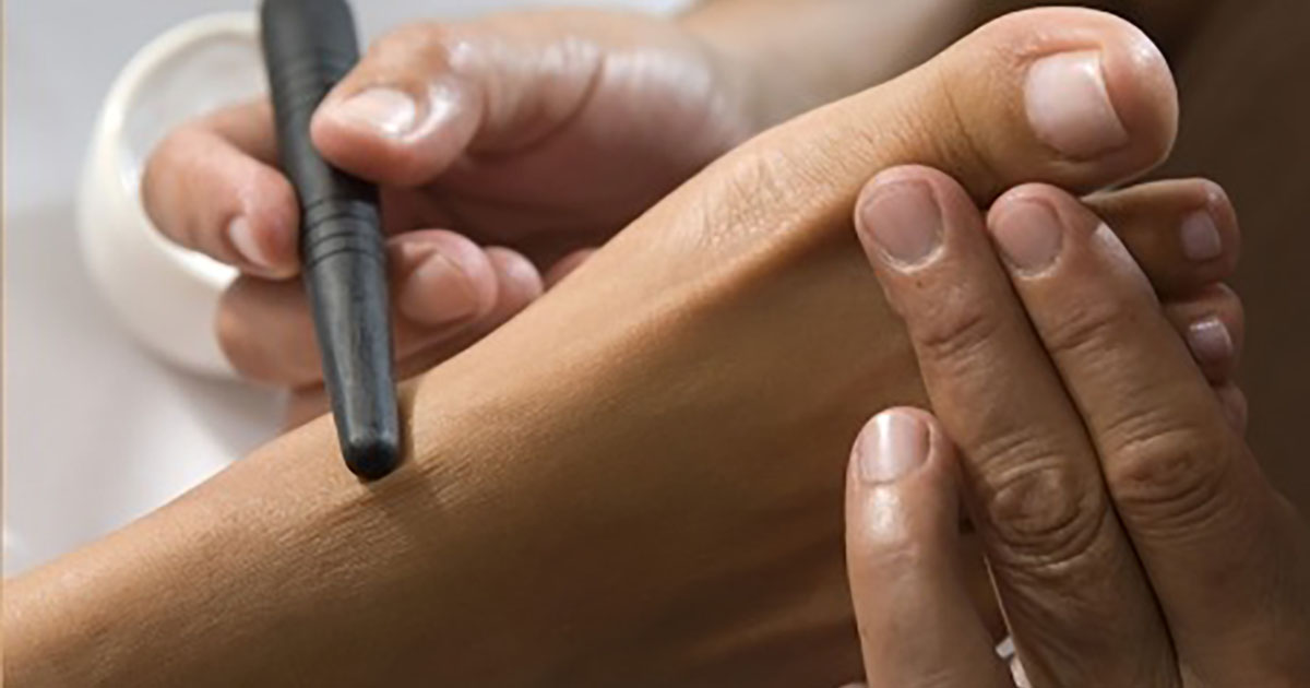 Cartographie des zones réflexes